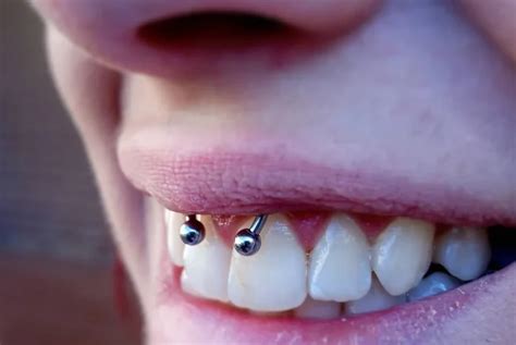 how long for smiley to heal|Smiley Piercings: Placement, Aftercare, Risks, and More